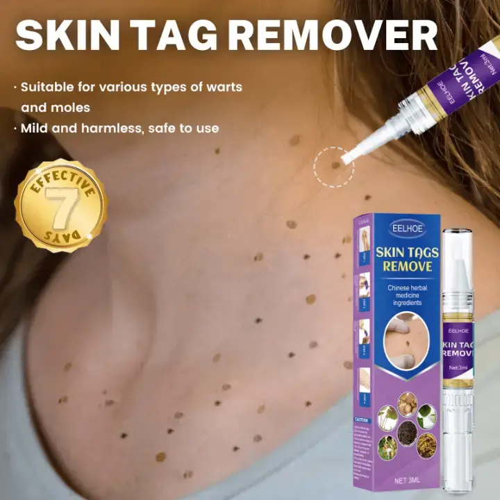 Supports Various Health Needs Skin Tag Remover
